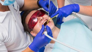 Tooth Extraction in Tampa, FL: What to Expect & How to Prepare
