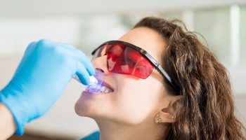 Tampa’s Guide to a Brighter Smile: What to Know Before Teeth Whitening