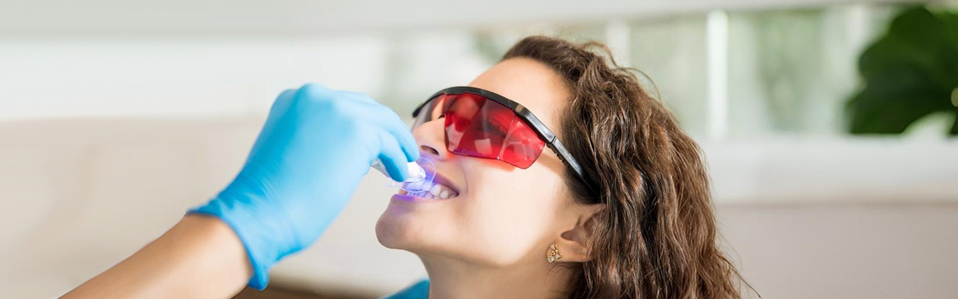 Tampa’s Guide to a Brighter Smile: What to Know Before Teeth Whitening